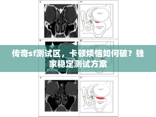 传奇sf测试区，卡顿烦恼如何破？独家稳定测试方案