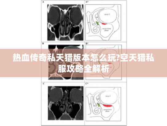 热血传奇私天猎版本怎么玩?空天猎私服攻略全解析 热血传奇私天猎版本怎么玩?空天猎私服攻略全解析
