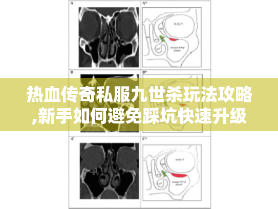 热血传奇私服九世杀玩法攻略,新手如何避免踩坑快速升级? 热血传奇私服九世杀玩法攻略,新手如何避免踩坑快速升级?