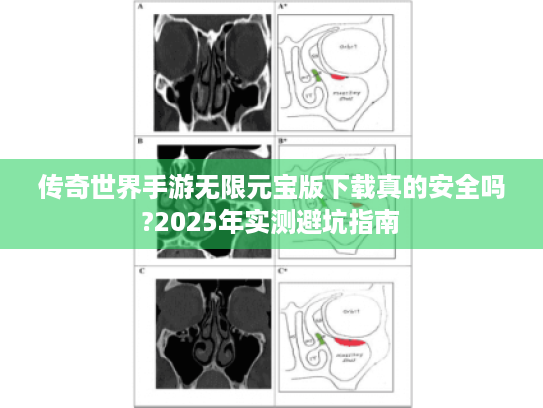 传奇世界手游无限元宝版下载真的安全吗?2025年实测避坑指南