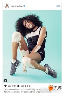 《模拟人生4》白癜风模拟人走红全球,独特造型引关注 《模拟人生4》白癜风模拟人走红全球,独特造型引关注