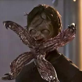 《生化4重制版》专家难度寄生虫挡招攻略! 《生化4重制版》专家难度寄生虫挡招攻略!