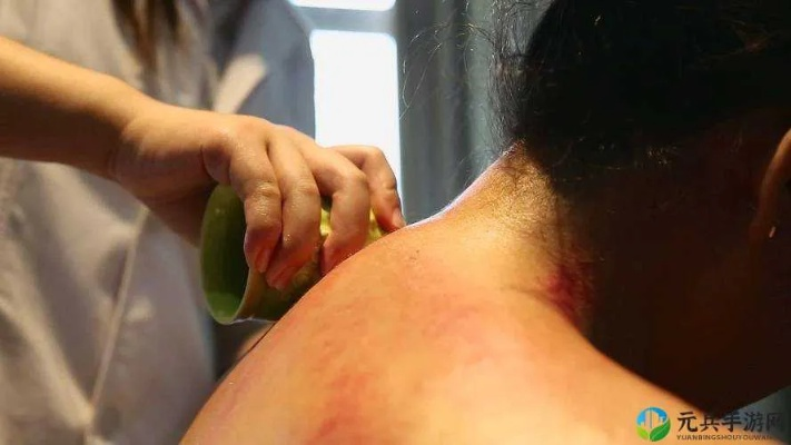 坦克刮痧流新解:传奇玩法深度剖析 坦克刮痧流新解:传奇玩法深度剖析