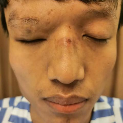 天使基因全解析：最强蜗牛进化奥秘深度揭秘